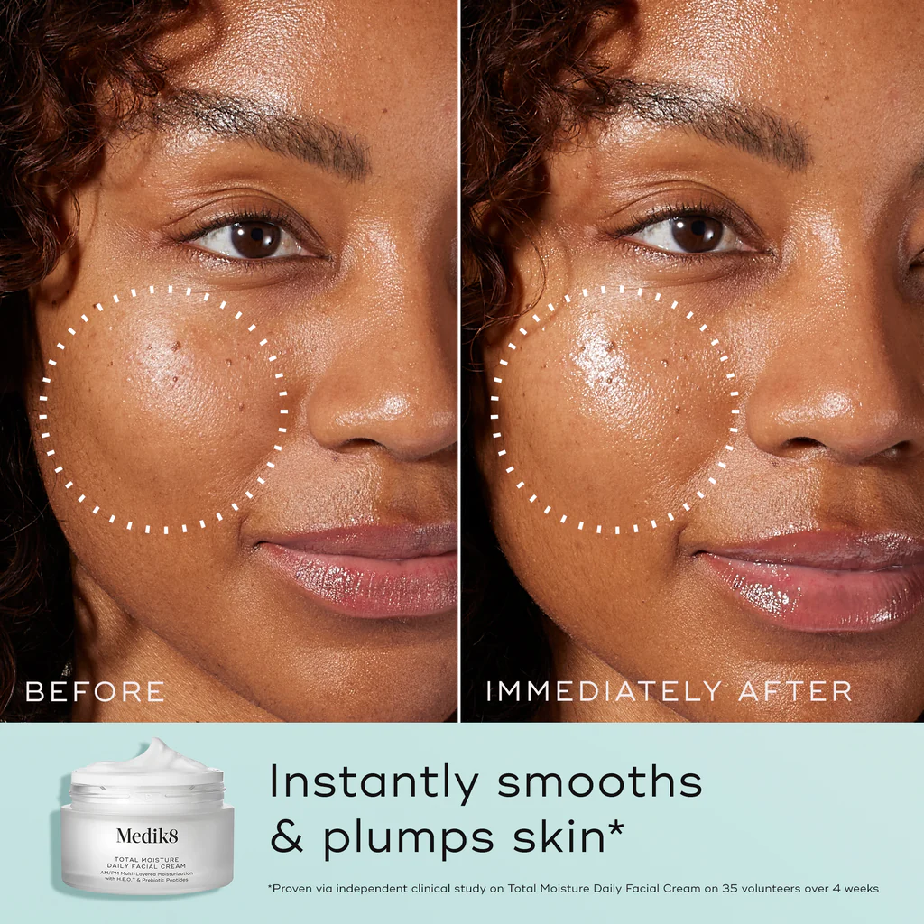 Total Moisture Daily Facial Cream - Imagen 2